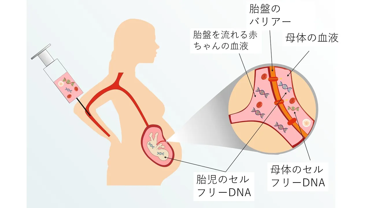 NIPTで陽性になったら？その後のフローを解説